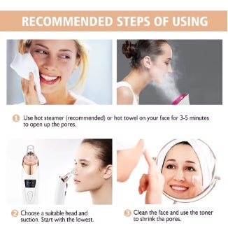 Electric Blackhead Remover